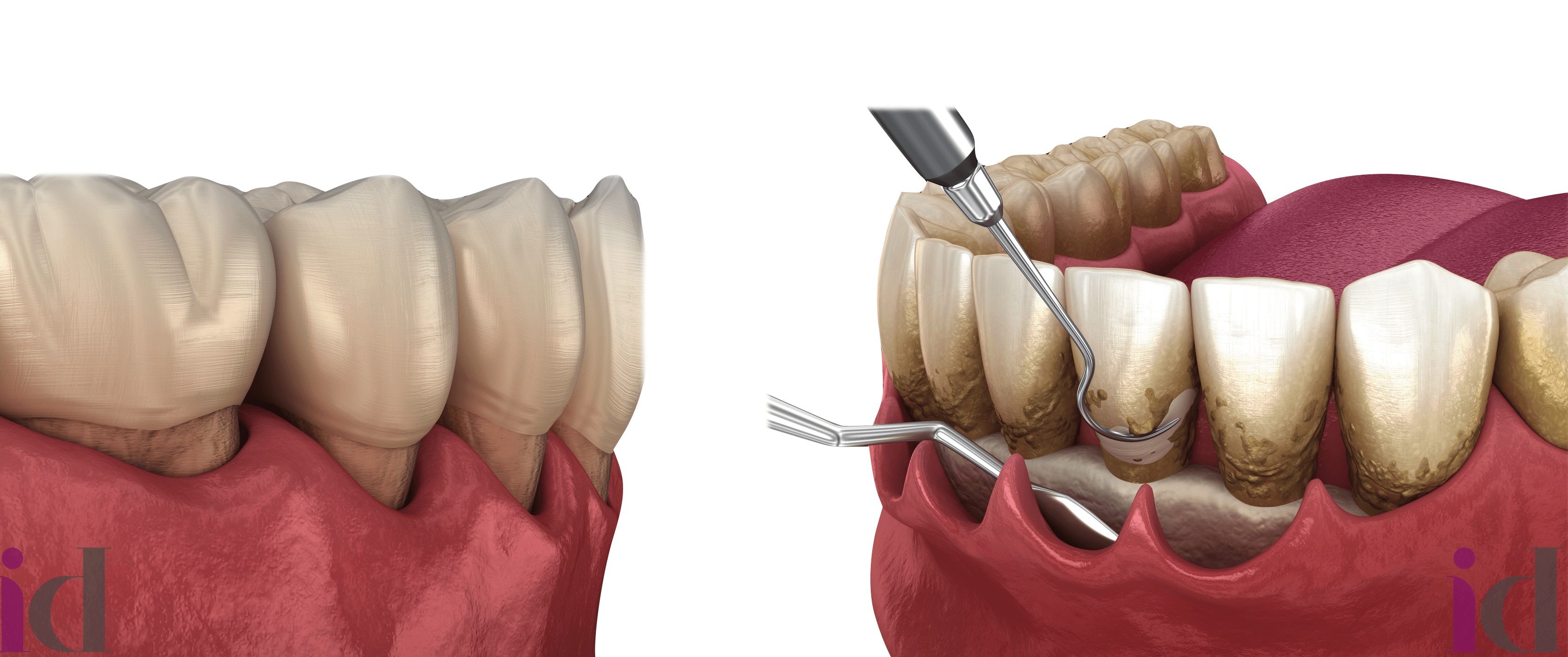 chirurgia parodontale blocco 2